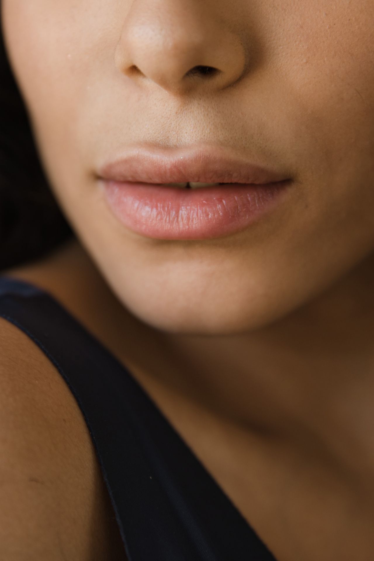Bullhorn, corner lift czy Italian lip lift? Różnice między metodami liftingu ust